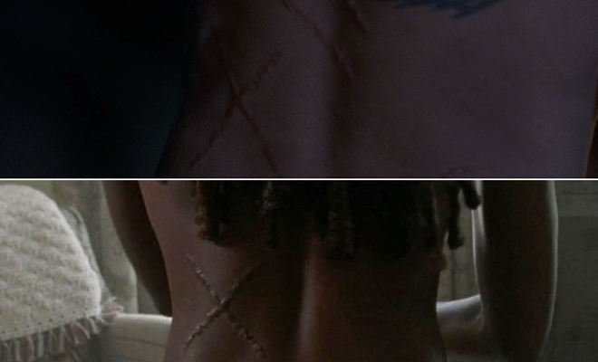 O que pode vir a ser a cicatriz em “X” nas costas dos sobreviventes em The Walking Dead?